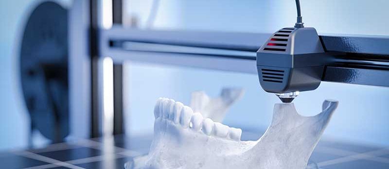 Printing a human jaw along with its teeth using 3D bioprinting - the future of dentistry and medicine